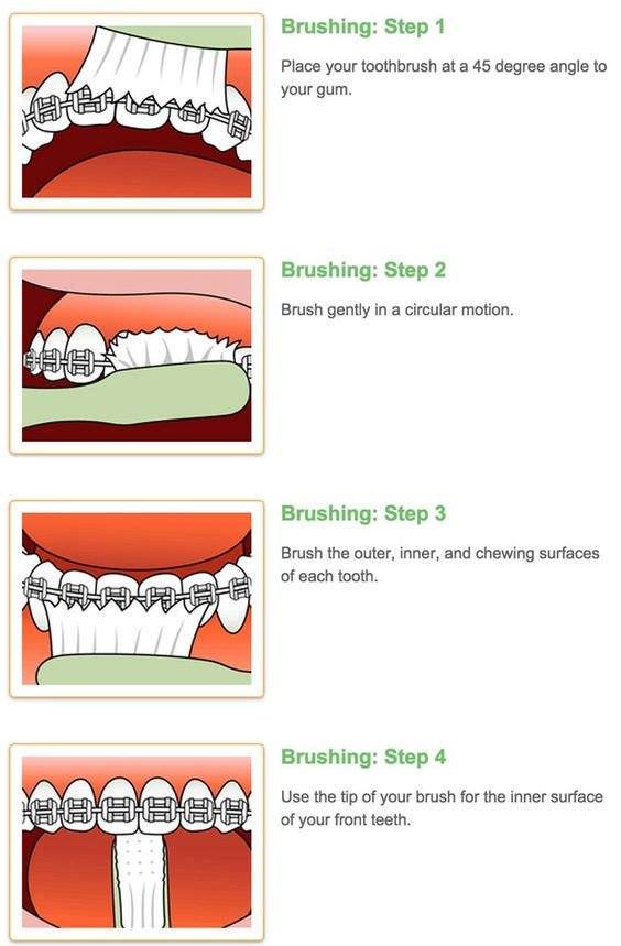 Tooth Brushing procedures